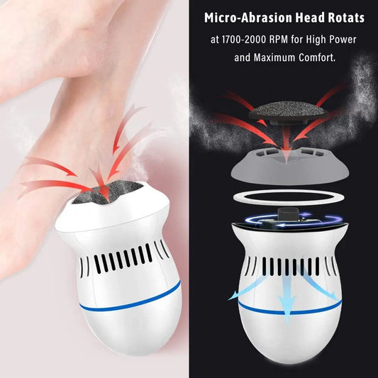 Electric Vacuum Callus Remover